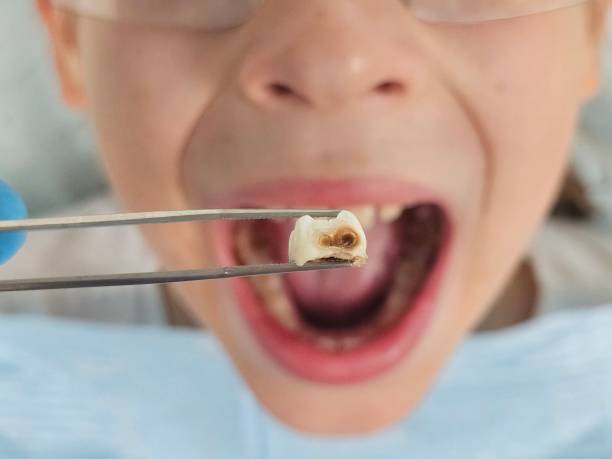 Best Weekend Emergency Dentist in Rancho Tehama Reserve, CA